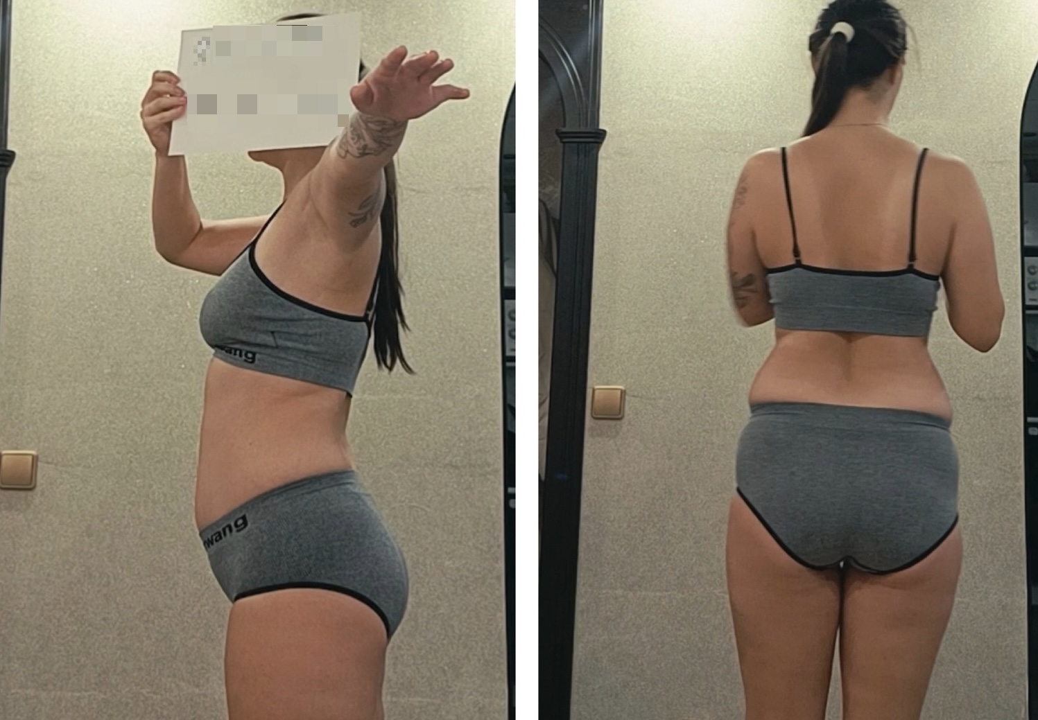 Anna P. - Before