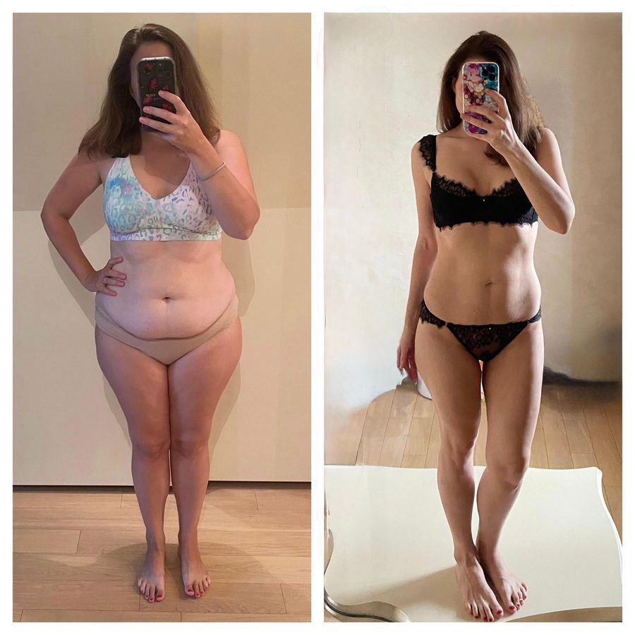 Julia - Before and After