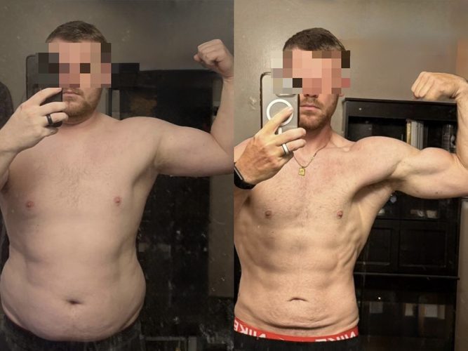 Michael R. - Before and After